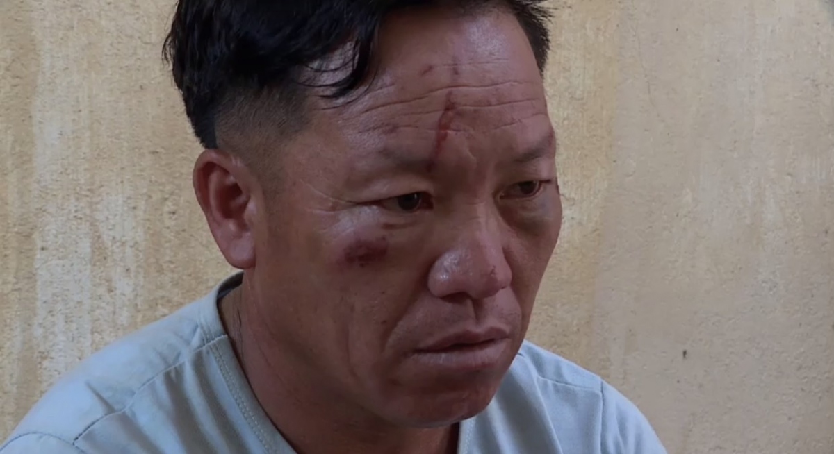 2 Công an ở Sơn La bị thương khi vây bắt đối tượng mua bán ma túy